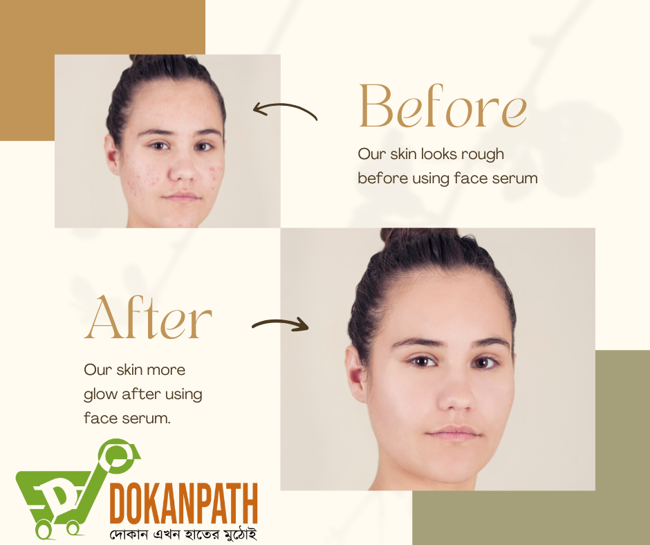 Parley Nomarks (pnam) No Marks Cream For Spot and Acne Pimple Removal - Image 2